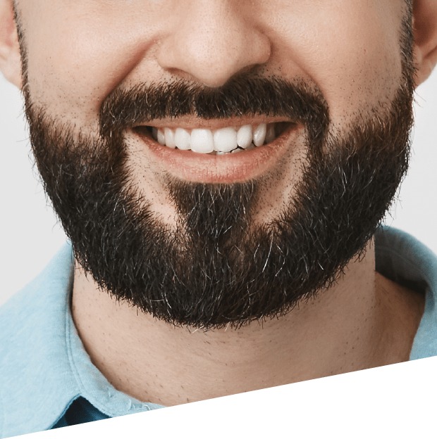 Beard-hair-transplant.jpeg