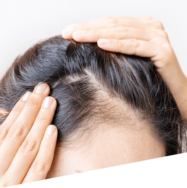 Hair-Loss-Treatment-1.jpeg